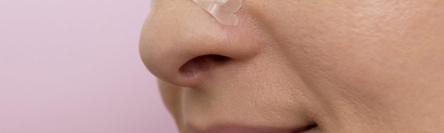 Best Anti Snoring Nose Strips